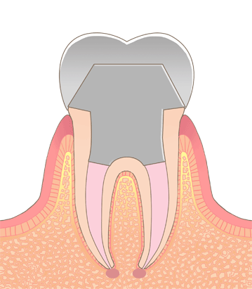 精密根管治療 田町駅 三田駅すぐの根管治療専門医院 田町芝浦歯科
